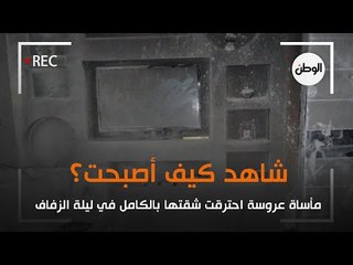 مأساة عروسة احترقت شقتها بالكامل في ليلة الزفاف ..  شاهد كيف أصبحت؟