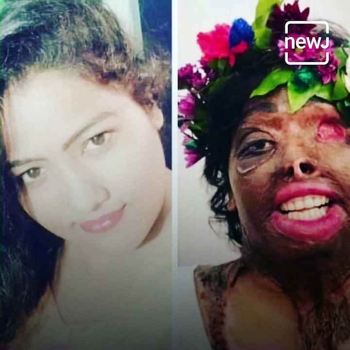 The Inspiring Tale Of Zakira Shaikh, An Acid Attack Survivor Who Followed Her Dreams