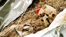 Skulls, bones recovered from hospital premises in Wardha