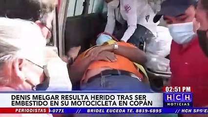 Lesionado resulta motociclista tras embestida en Copán