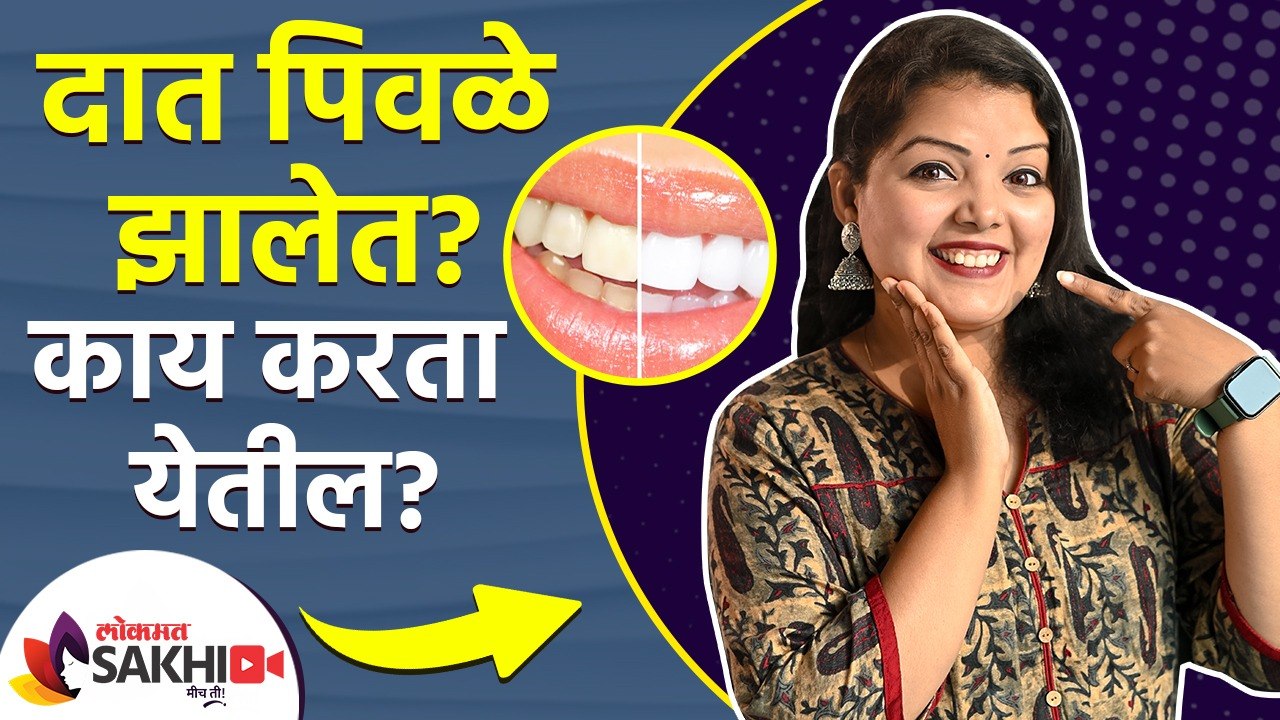 २ मिनिटांत दातांचा पिवळेपणा दूर करा | How to Wh...