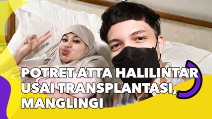 9 Potret Atta Halilintar Usai Transplantasi, Manglingi dengan Rambut Lebat