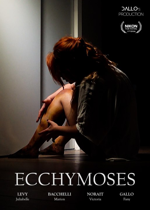Ecchymoses