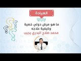 العيادة| ما هو مرض دولي خصية وكيفية علاجه؟  د/ محمد صلاح البدري يجيب