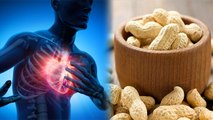 मूंगफली खाने से जानलेवा बीमारी से बचाव,Blood Pressure से लेकर Heart Attack तक में फायदेमंद | Boldsky
