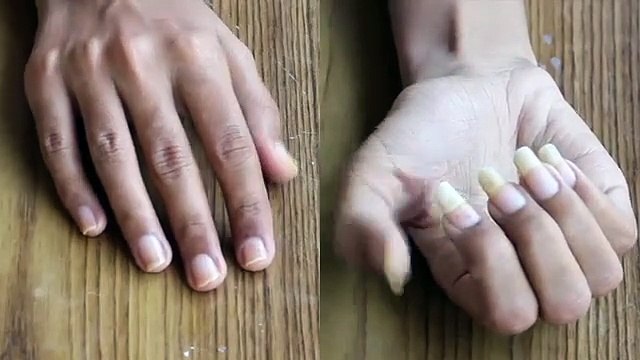 خلطة تطويل الأظافر في 3 أيام بالليمون وفيتامين هـ