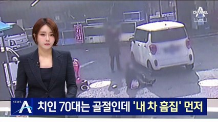 치인 70대는 골절인데…운전자는 ‘내 차 흠집’ 먼저 확인