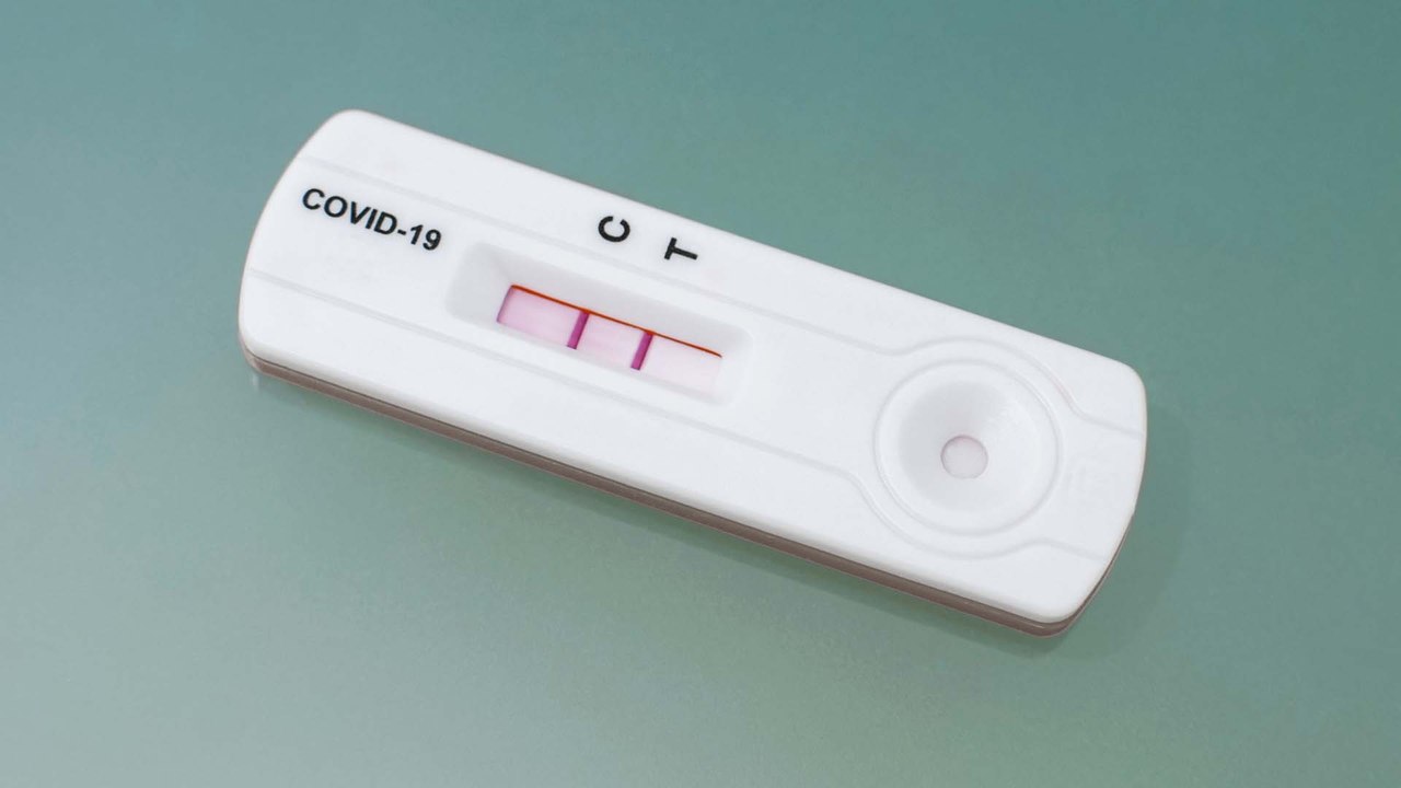 Positiver Corona-Test? Was du jetzt tun solltest