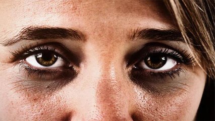 इन 2 वजह से भी Dark Circle होते है, जाने कारण और उपाय | Boldsky