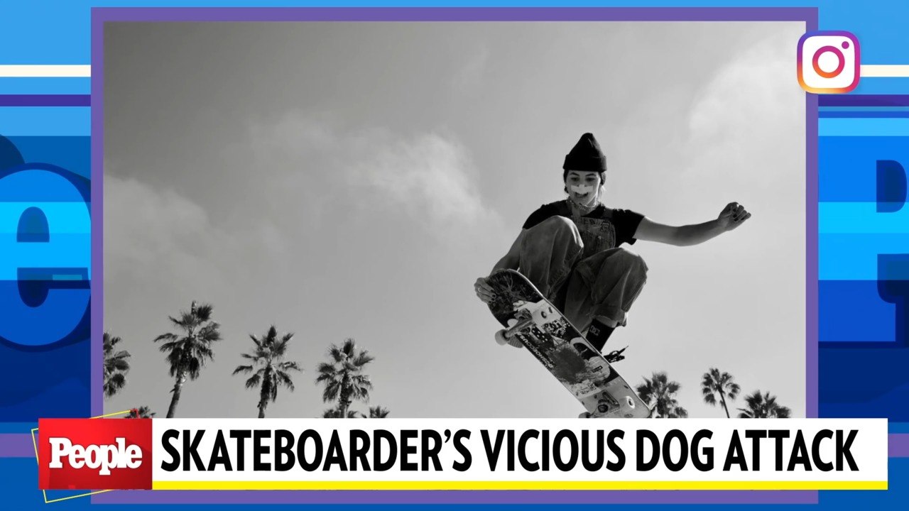 Pro Skateboarder and Model Brooklinn Khoury Shares Journey of Healing After Losing Lip in Dog Attack