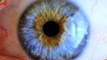 Eye Opening! Retinal Scan May Show if You’re at Risk of Early Mortality!