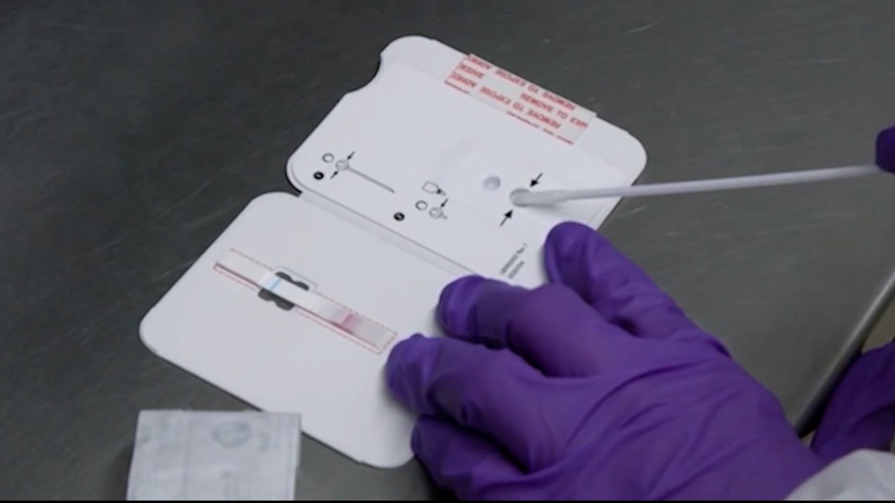 ¿Falsos positivos? La diferencia en las pruebas caseras de antígeno y las de PCR