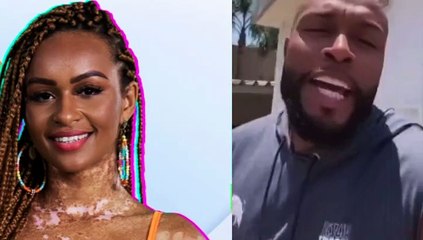 Participante com vitiligo da atual edição do BBB é chamada de "dálmata" por humorista Nego Di