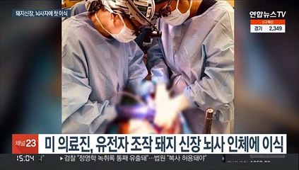 '유전자 조작' 돼지 신장, 뇌사판정 인체에 첫 이식