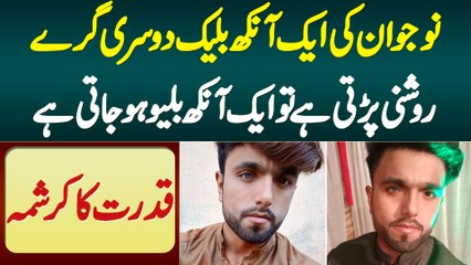 Qudrat Ka Karishma - Naujawan Ki Ek Ankh Black Aur Doosri Grey, Roshni Parti Hai To Blue Ho Jati Hai