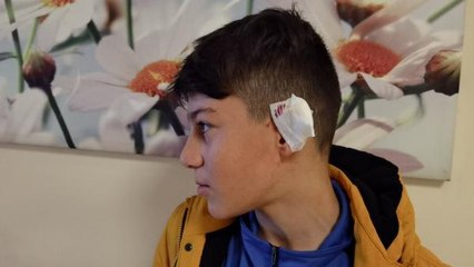 ALMAN ÇOBAN KÖPEĞİNİN SALDIRDIĞI YUSUF'UN KULAĞINDA DOKU KAYBI VAR