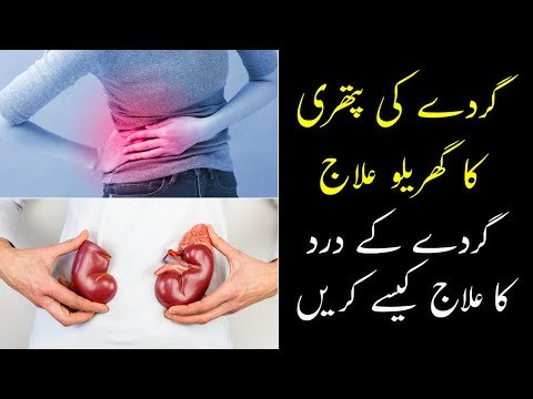 Kidney Stone Treatment at Home | Gurde Ki Pathri Ka Ilaj | Pathri Ki Alamat | Gurde Ka Dard Ka Ilaj