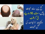 Hair Transplant in Pakistan | Ganj Pan Ka Ilaj | Vagus Cosmetics | Dr Sadaf Tips