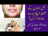 Keel Muhase Ka Gharelu Ilaj | Acne Scar Removal | Acne Treatment at Home | Dr Sadaf