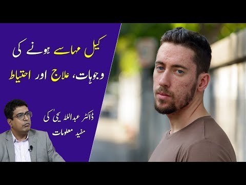 Get Rid Face Acne | Dr. Abdullah Yahya | Acne Scars Treatment