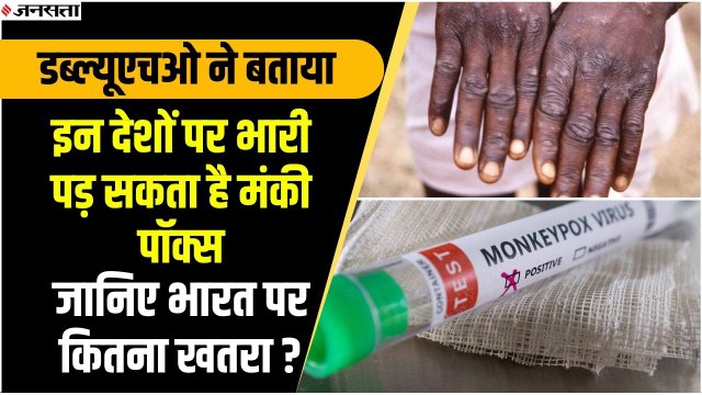 इन देशों पर भारी पड़ रहा है मंकी पॉक्स, जानिए भारत पर कितना खतरा? | Monkeypox Virus