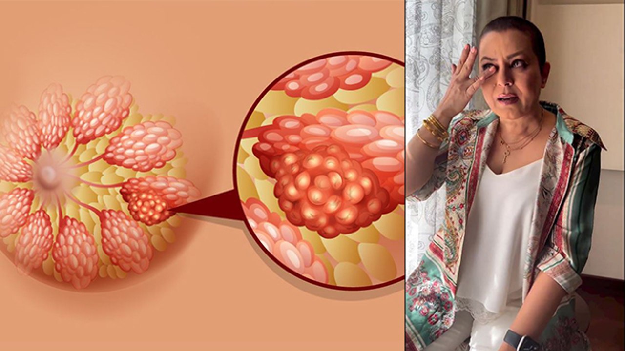 Mahima Chaudhry का Breast Cancer Symptoms Reveal, Lump कैसा दिखता था |Boldsky *Entertainment