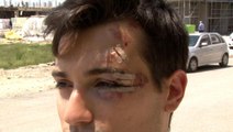 Bisikletiyle üniversiteye giden öğrenci sokak köpeklerinin saldırısına uğradı