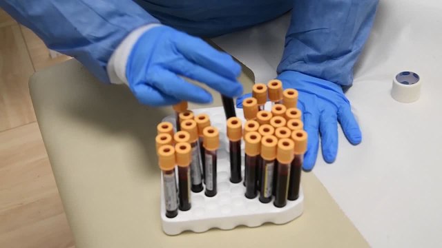 Sangue, donazioni in ripresa ma ancora lontani i livelli pre-Covid