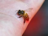 Bienen- oder Wespenstich? Das kannst du dagegen tun
