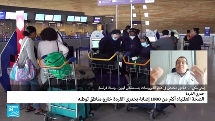 أكثر من 1000 أصابة بجدري القردة خارج مناطق توطنه