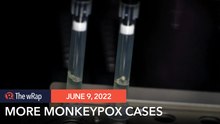 More than 1,000 monkeypox cases reported to WHO – briefing