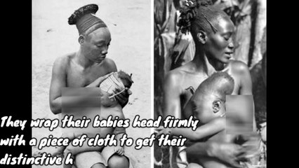 What is Limpobo: Baby head deformed, Head binding why?