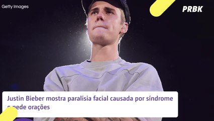 Justin Bieber revela paralisia facial e explica adiamento de turnê: "Fisicamente incapaz"