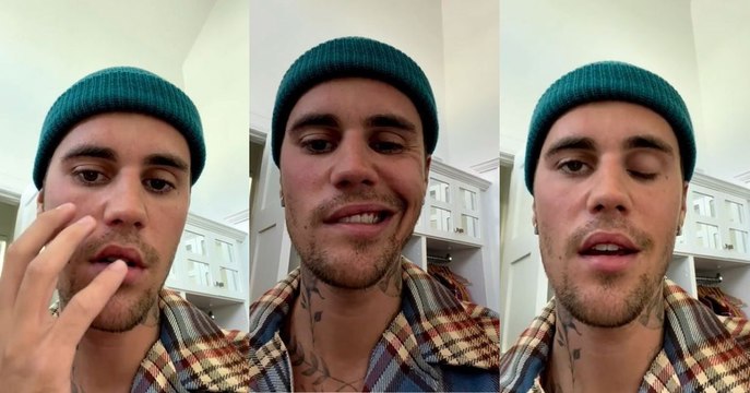 Es bastante serio : Justin Bieber sufre parálisis facial debido a un virus con el que viene luchando