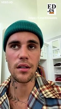 Justin Bieber anuncia que tiene parálisis facial