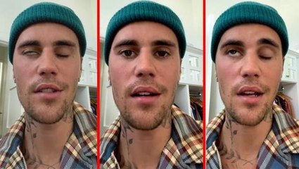 Justin Bieber yüz felci geçirdi! Sadece bir gözünü oynatabiliyor