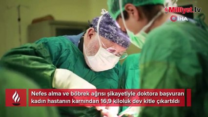 Ameliyata 65 kilo girdi, 48 kiloya düştü! 40 yıllık doktor bile şaşırdı