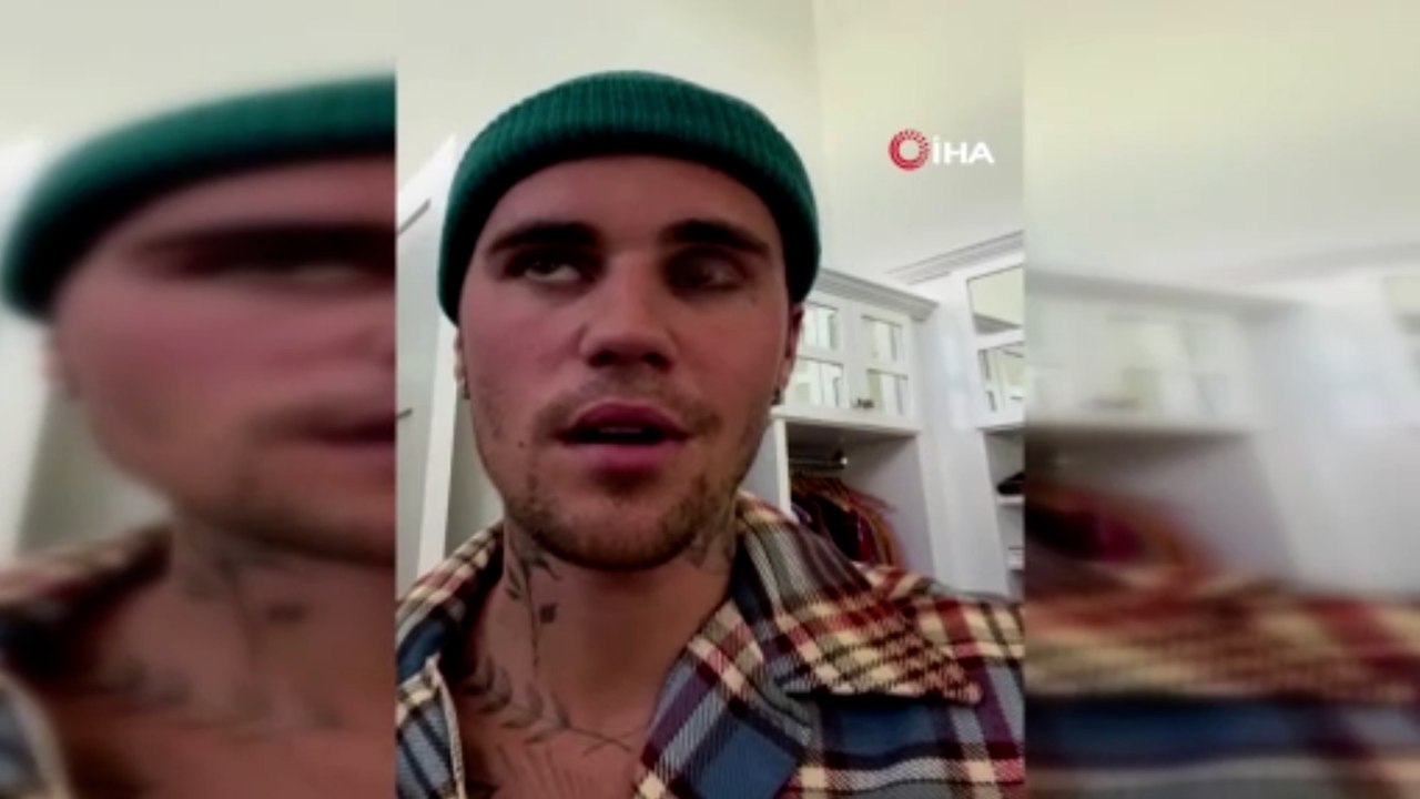 Justin Bieber yüz felci geçirdi