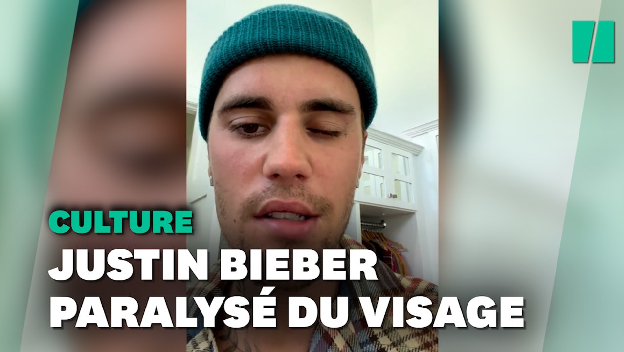 Paralysé d'un côté du visage, Justin Bieber annule des dates de concert