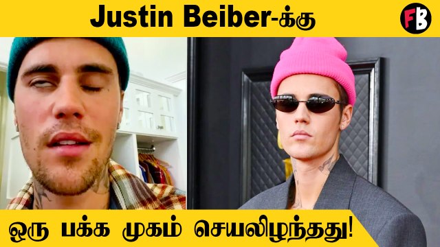 Justin Beiber | மோசமான பக்கவாத பாதிப்பு, சோகத்தில் ரசிகர்கள் *Hollywood | Filmibeat Tamil
