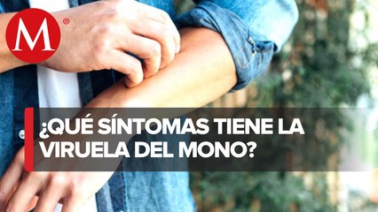 Detectan segundo caso de viruela del mono en México