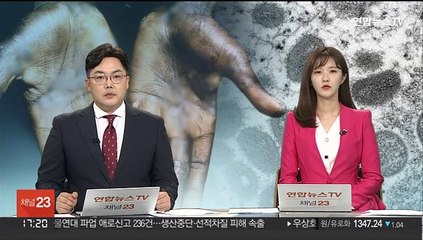 원숭이두창 고위험 접촉자 21일 격리…치료제도 도입