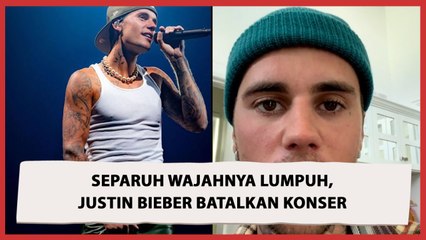 Idap Sindrom Ramsay Hunt, Justin Bieber Batalkan Sejumlah Konser