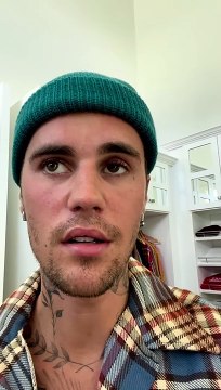 El cantante canadiense Justin Bieber sufre de la parálisis de los músculos de la mitad de su cara por un virus bastante serio