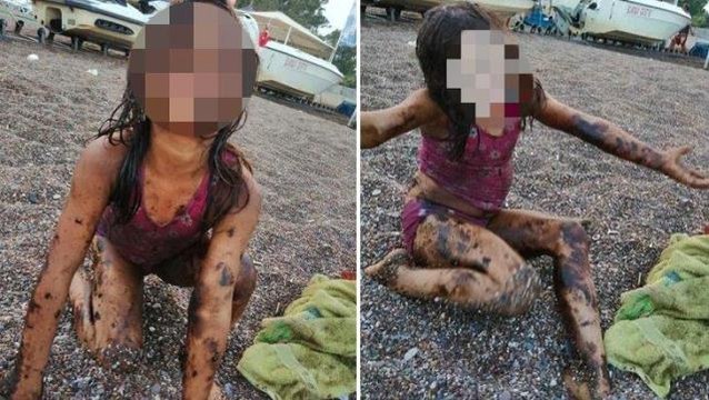 Türkiye'nin tatil cennetinde ürküten görüntü! Denize giren vücudunda siyah lekelerle çıkıyor