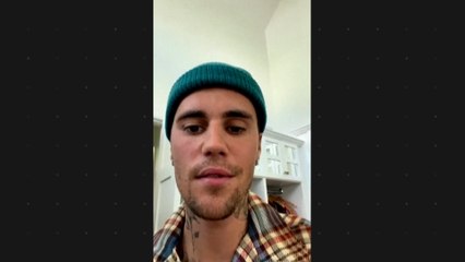 Justin Bieber über seine Krankheit: "Eine Gesichtshälfte ist gelähmt"