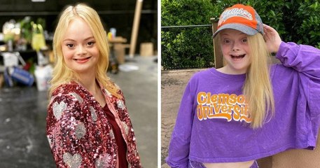 Actrice, mannequin et activiste, Lily D. Moore brise les préjugés sur la trisomie 21