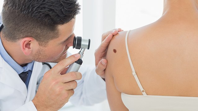 bd-prevencion-y-deteccion-temprana-del-cancer-de-piel-130622