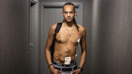 «Je peux manger mais je n’absorbe plus rien» : Christopher raconte sa vie sans intestin