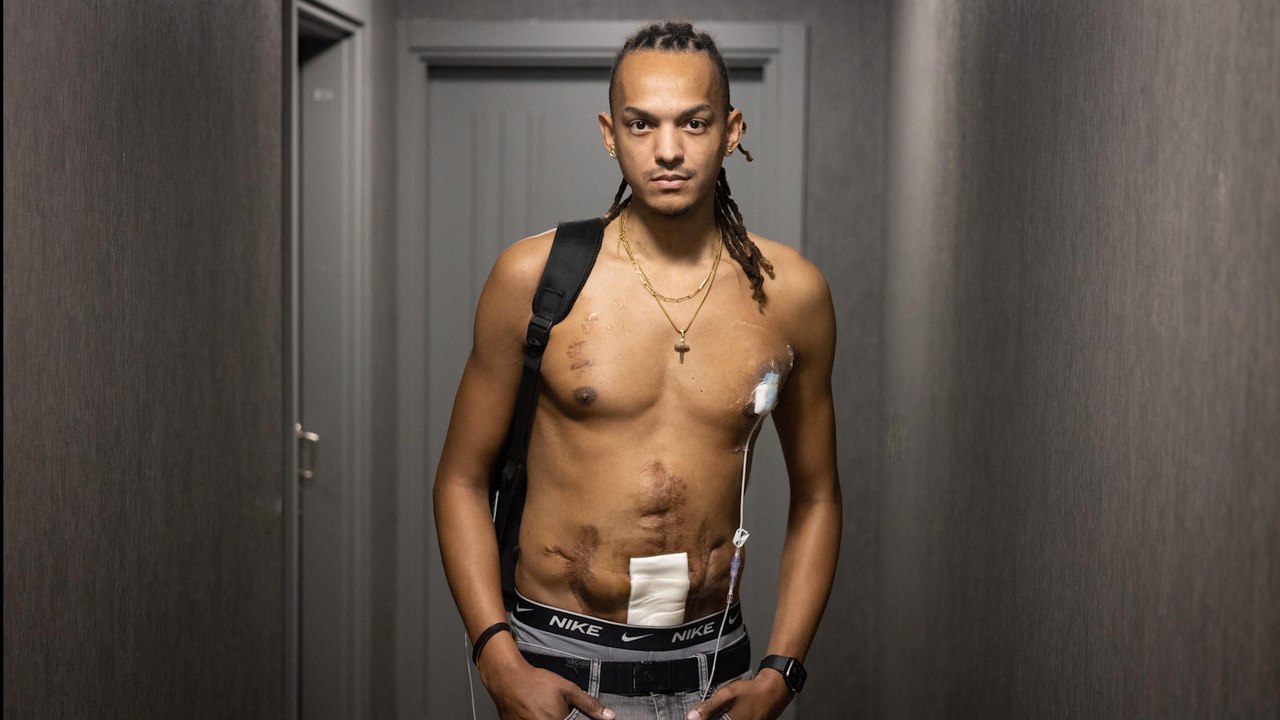 «Je peux manger mais je n’absorbe plus rien» : Christopher raconte sa vie sans intestin